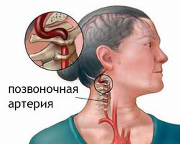 Упражнения по Шишонину от остеохондроза